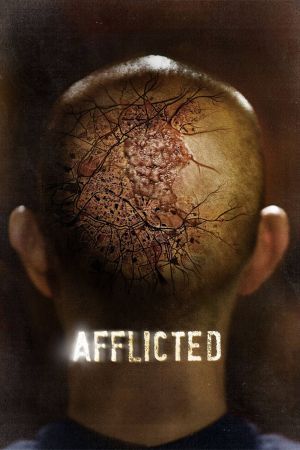 Contracted